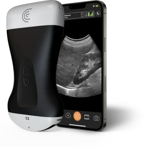 Clarius C3 HD3 Escáner Multipropósito